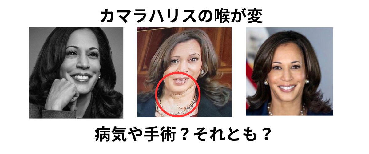 カマラハリスの喉が変