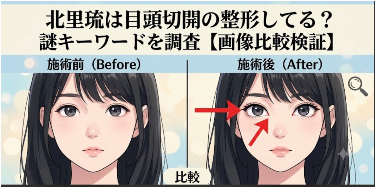 北里琉は目頭切開の整形してる？謎キーワードを調査【画像比較検証】